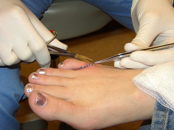 Consejos para Elegir Abogados Accidentes