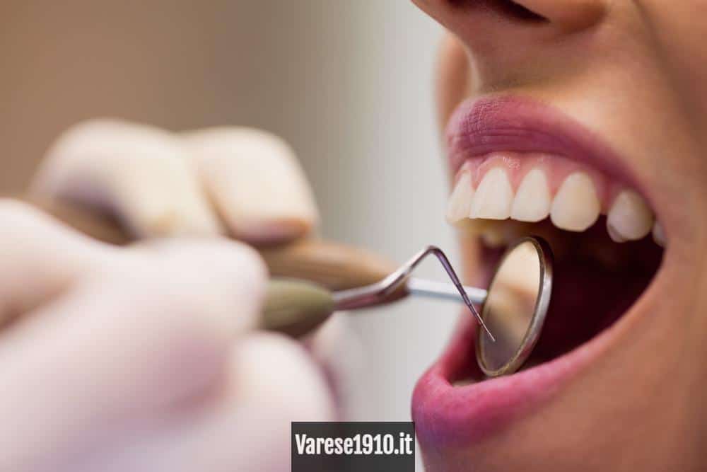 Blanqueamiento dental Barcelona