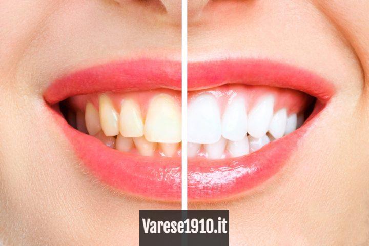 blanquemiento barcelona