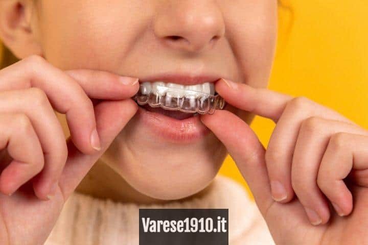 Estetica dental en Valencia